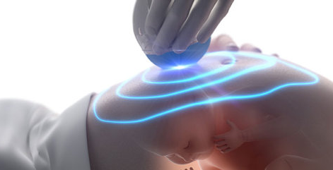 关于四维彩超，你了解多少?